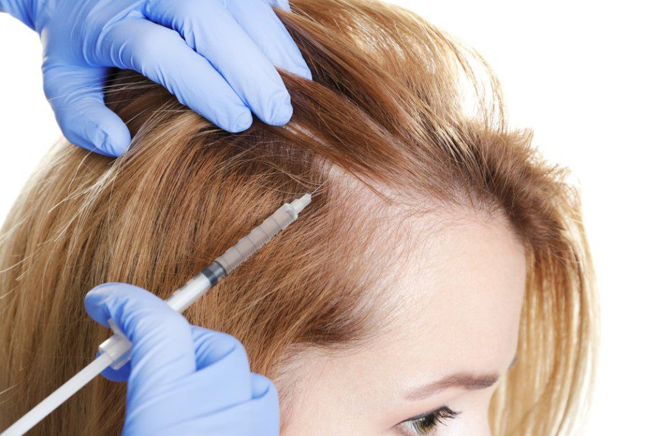 Hair Loss Treatment Clinic in Portland - PRP Injection For Hair Loss